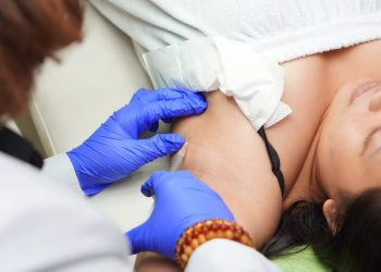 Atasi Ketiak Basah dan Bau karena Keringat Berlebih dengan Botox